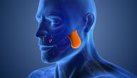 Napetost i bol u maseteričnom „mišiću žvakaču” dovodi do sindroma temporomandibularnog zgloba (TMZ)
