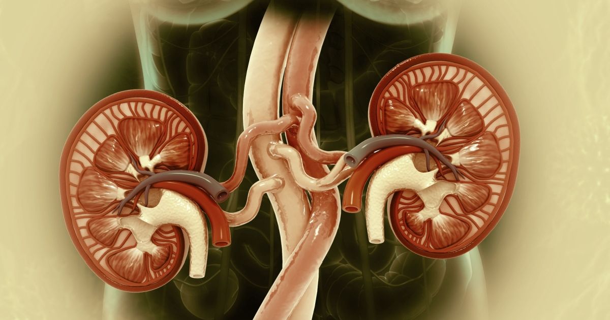 IgA Nephropathy is Chronic. If Untreated, It Can Lead to Kidney Failure