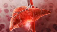 Koliko su opasni benigni tumori jetre i da li svi zahtevaju lečenje