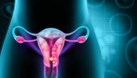 Zašto endometrioza izaziva tako iscrpljujući, hronični bol