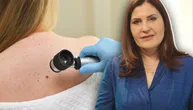 Pregledi mladeža su važni jer ako se rak kože rano otkrije, izlečiv je 100 odsto, poručuje dr Lidija Kandolf