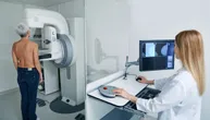 Nove smernice za mamografiju podelile stručnjake: Da li je dovoljno raditi pregled na dve godine?