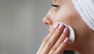 Antibiotici za akne: Kome mogu da pomognu i koliko dugo smeju da se koriste?
