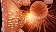 Zašto je tumor marker CA 15-3 važan za praćenje karcinoma dojke?