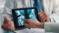 Jedna vrsta ribe čuva kosti i štiti od osteoporoze, posebno ako smo stariji od 50 godina