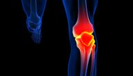 Osteoartritis kolena može da se ublaži promenom načina hoda i položajem stopala