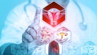 Inovativne terapije donose novu nadu za žene sa uznapredovalim karcinomom endometrijuma