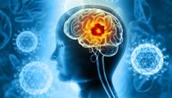 Dostignuća neuroonkologije: Tumor mozga od sada može da se dijagnostikuje za 12 minuta umesto za 12 dana