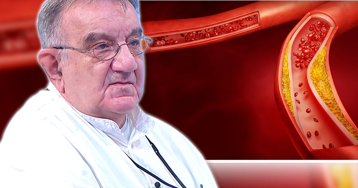 Высокий холестерин излечим: Три золотых совета известного гастроэнтеролога по контролю холестерина и жиров в крови