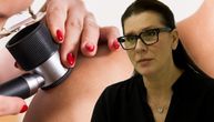 Dermoskopija omogućava da se promene na koži „uhvate” na vreme i čoveku spasi život, ističe dr Marta Terzić