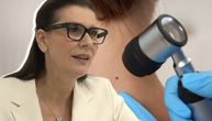 Sunce i mladeži nisu bezopasna kombinacija, UV zraci mogu da oštete DNK ćelija, upozorava dr Marta Terzić
