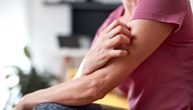 Da li i vi posežete za antihistaminikom kada vas zasvrbi koža? Kod ekcema možda neće pomoći