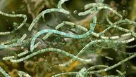Hrana zaražena bakterijom Bacillus cereus izgleda normalno, a simptomi trovanja javljaju se već za pola sata