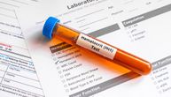 Medicinski vodič: Šta je test hematokrita (Hct) i kako se tumače konačni rezultati?