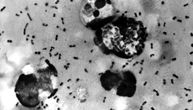 Plućna kuga je najzarazniji oblik izazivan bakterijom Yersinia pestis: EU pažljivo prati dešavanja u Rusiji