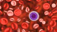 FDA odobrila novi lek za prvu liniju lečenja određenih oblika leukemije i limfoma