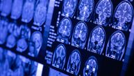 Klimatske promene ugrožavaju zdravlje mozga Evropljana i dodatno opterećuju već postojeće neurološke probleme